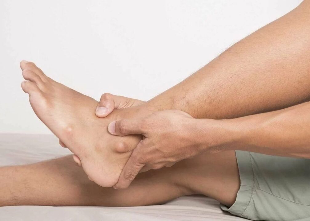 symptoms of ankle arthrosis