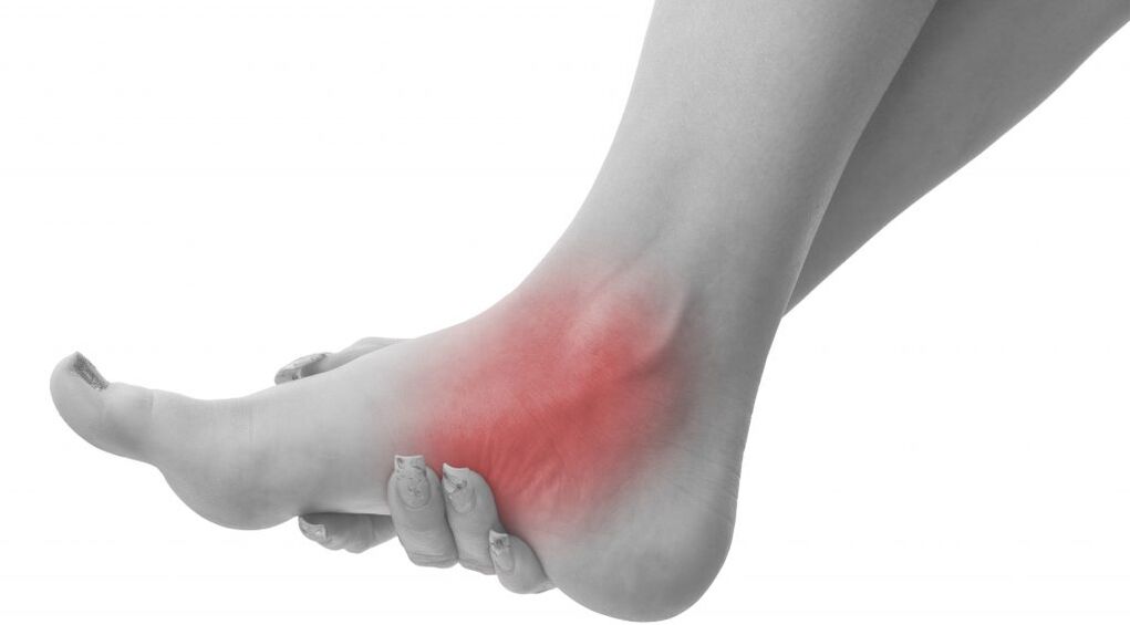 ankle pain due to arthrosis